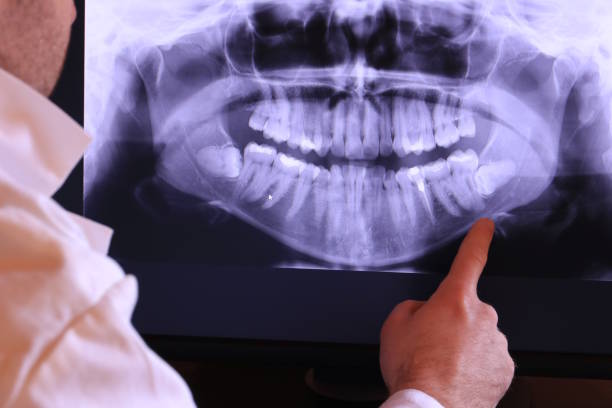 Best Broken or Cracked Tooth Emergency Dentist in Redan, GA